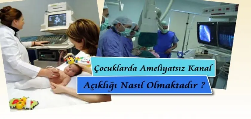 Çocuklarda Ameliyatsız Kanal Açıklığı Nasıl Olmaktadır