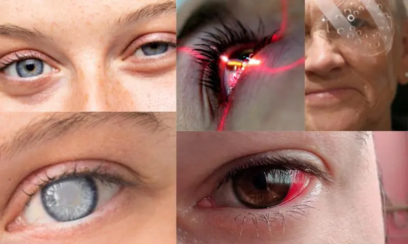 Lazer Göz Ameliyatı İçin Hangi Hastane Seçilmelidir?
