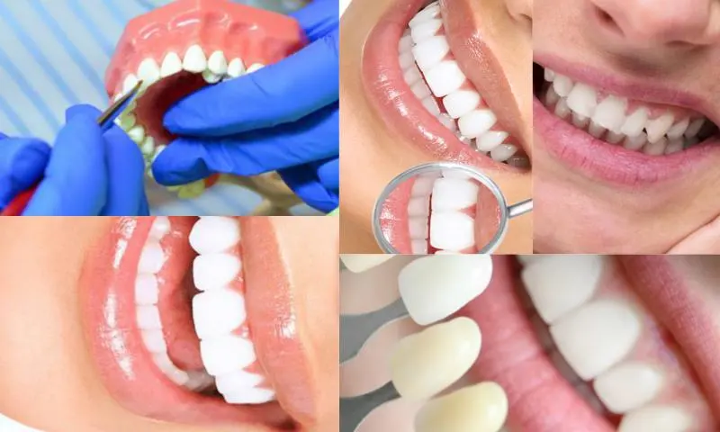 Zirkonyum Diş Kaplama Hangi Durumlarda Yapılır?
