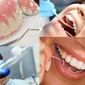 Düzce İmplant Nedir?